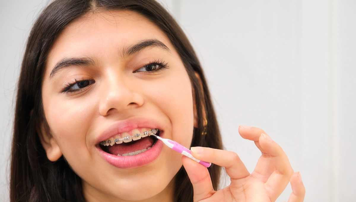 girl-cleaning-her-braces-1200x683.webp